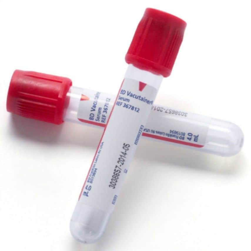 Vacutainer 10ml Plain Serum Tubes Red Cap PK100